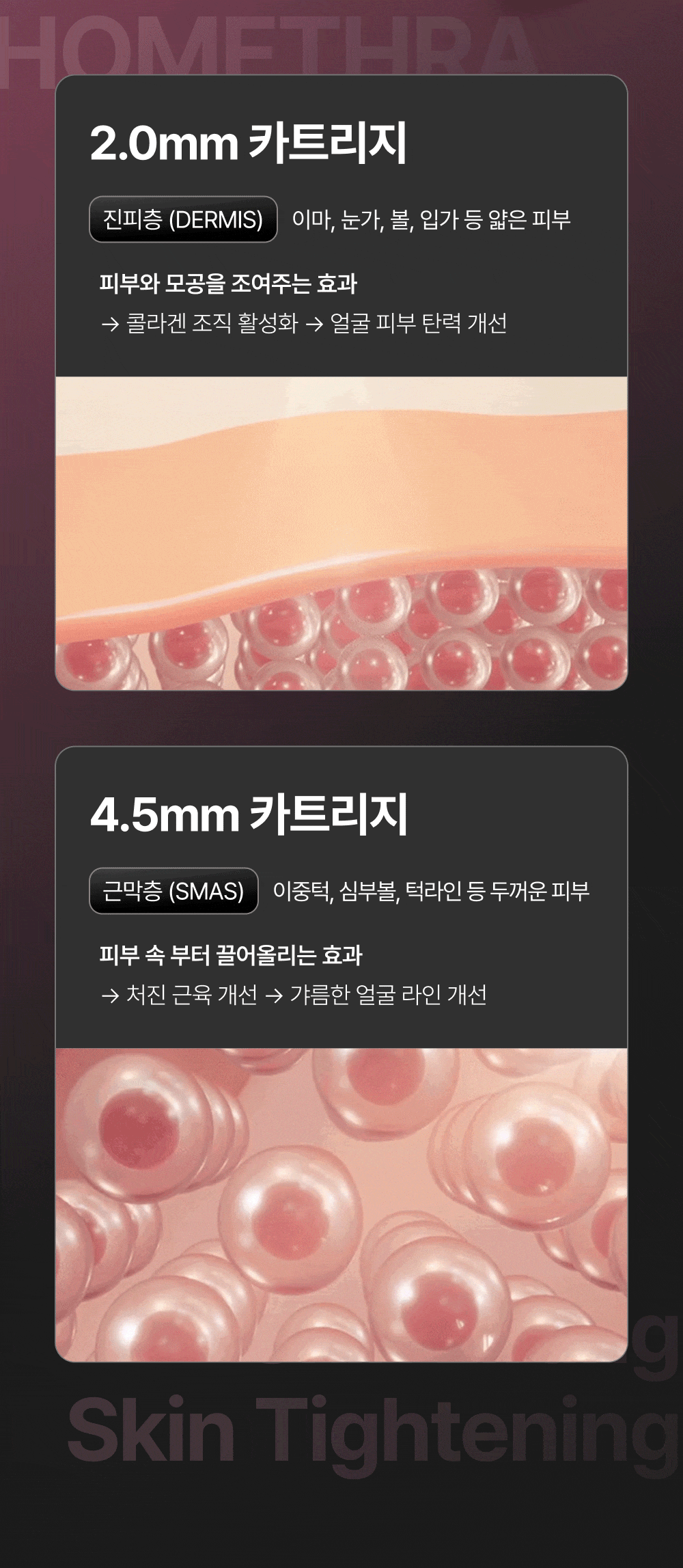 [아띠베뷰티] 홈쎄라 베이직케어 (5만샷 100만도트) (48개월) (2026) 상세 이미지 11