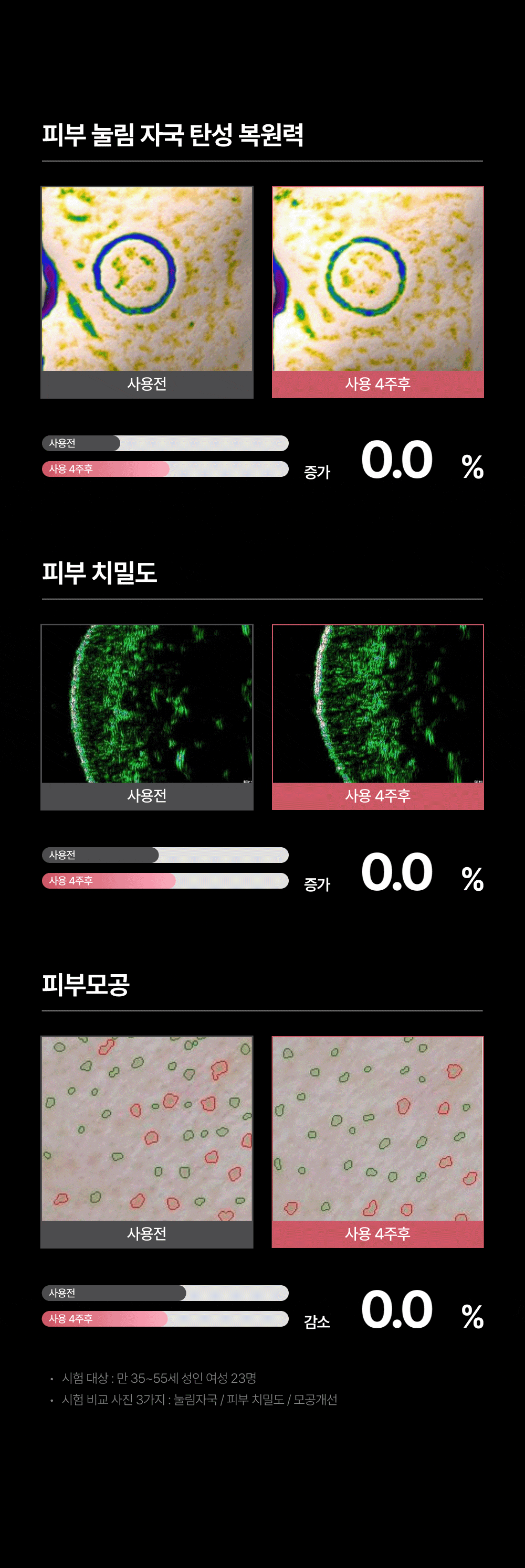 [아띠베뷰티] 홈쎄라 베이직케어 (5만샷 100만도트) (48개월) (2026) 상세 이미지 17
